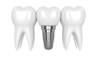 ���ö�Ʈ �̹���